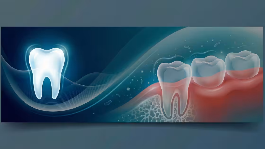 Periodontal Stages Page Top Graphic