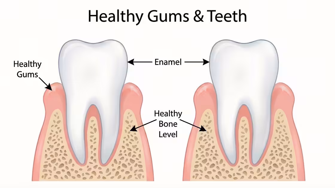 Healthy Gums