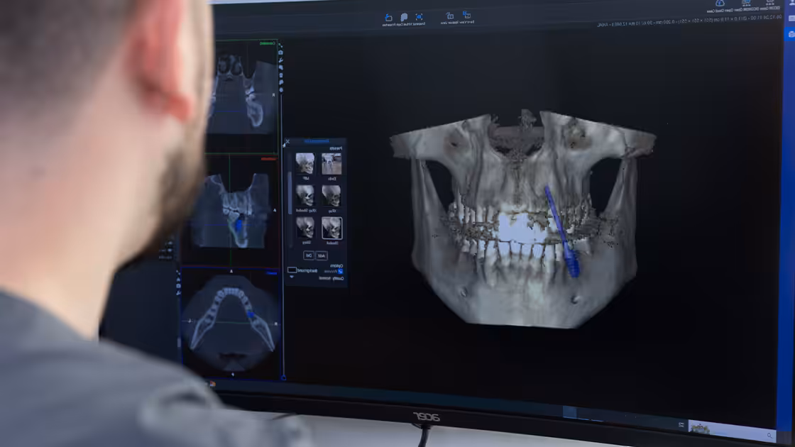 Dental technology