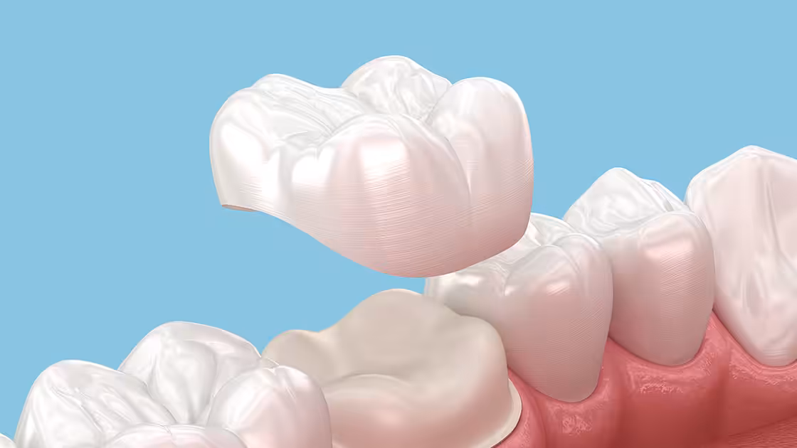 Same day restoration graphic